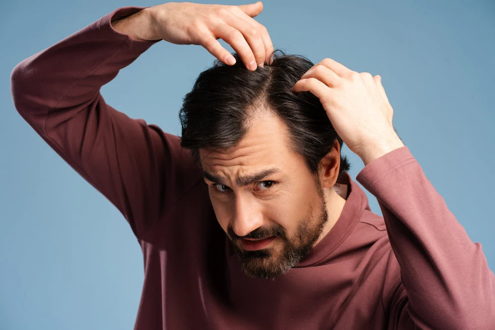 Best Doctor for Hair Loss Treatment in East Delhi